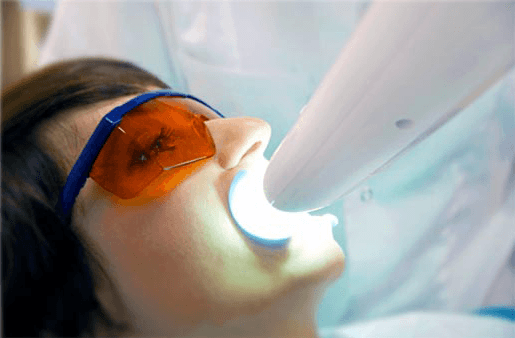 Understanding the Causes of Teeth Sensitivity Cambridge