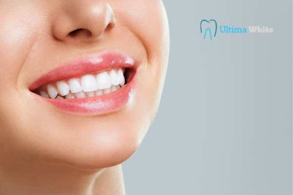 Common Mistakes That Can Ruin Your Whitening Results Cambridge