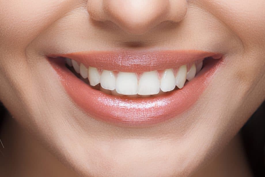 Why Do Some Teeth Whitening Results Fade Faster Than Others Cambridge?