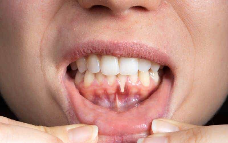 Final Thoughts: Building Lifelong Enamel Protection Habits Cambridge