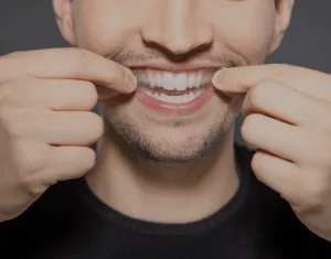 Overview of Home Teeth Whitening Kits Cambridge