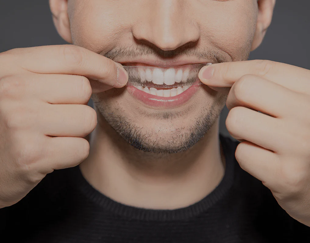 Can You Whiten Natural Teeth Without Harsh Chemicals Cambridge?