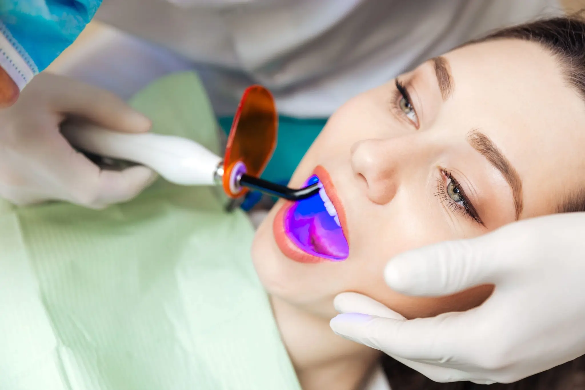 How Long Can You Expect Laser Teeth Whitening Results to Last Cambridge?