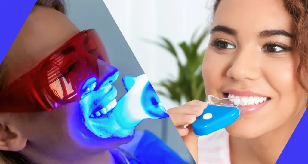 Comparing Teeth Whitening Methods: Laser Treatment vs At-Home Kits