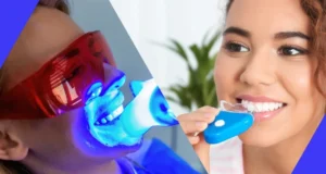 Impact of Home Kits Cambridge versus Professional Teeth Whitening Treatments