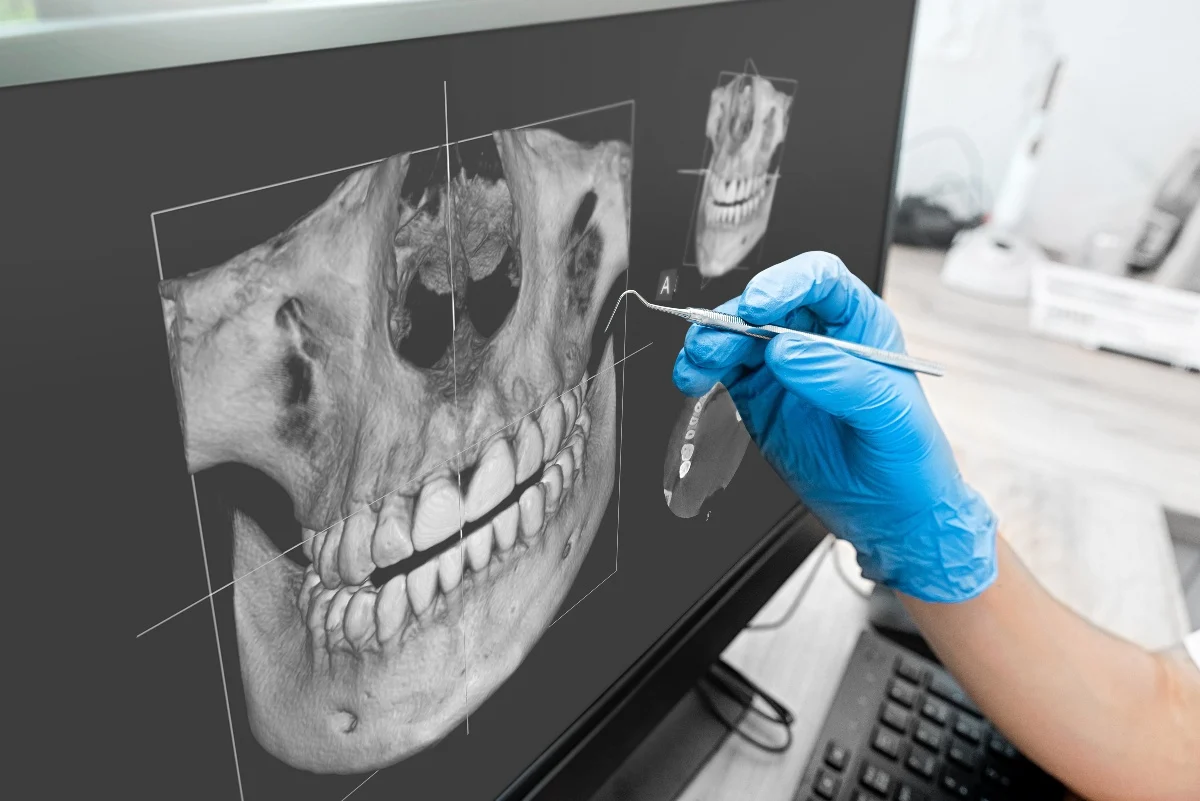 Key Benefits of 3D Printing for Patients and Dentists Cambridge