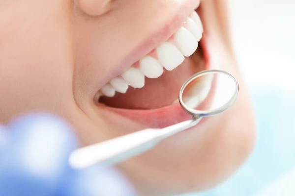 How to Maintain Your Whiter Smile After Treatment Cambridge