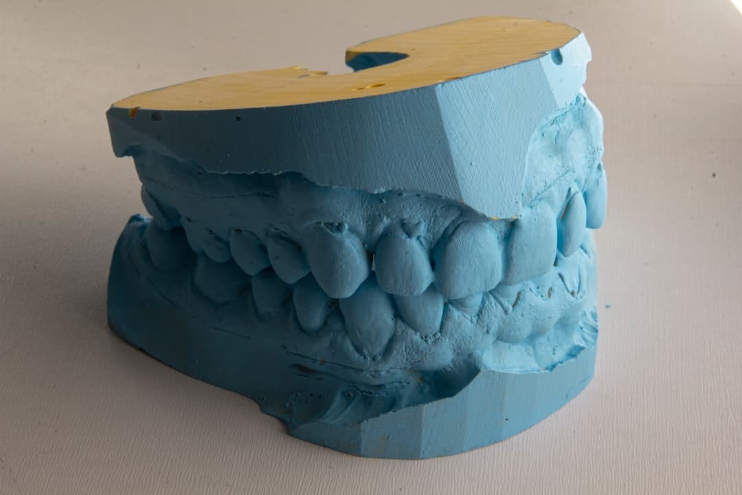 How Do Dental Implants Improve Jawbone Health and Oral Function Cambridge?