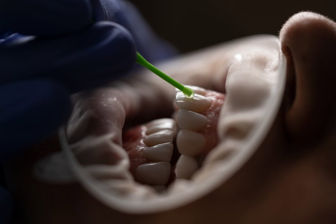 How Saliva Protects Your Teeth and Gums Cambridge