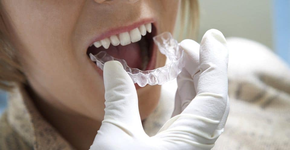 Can Bruxism Affect Your Sleep Quality Cambridge
