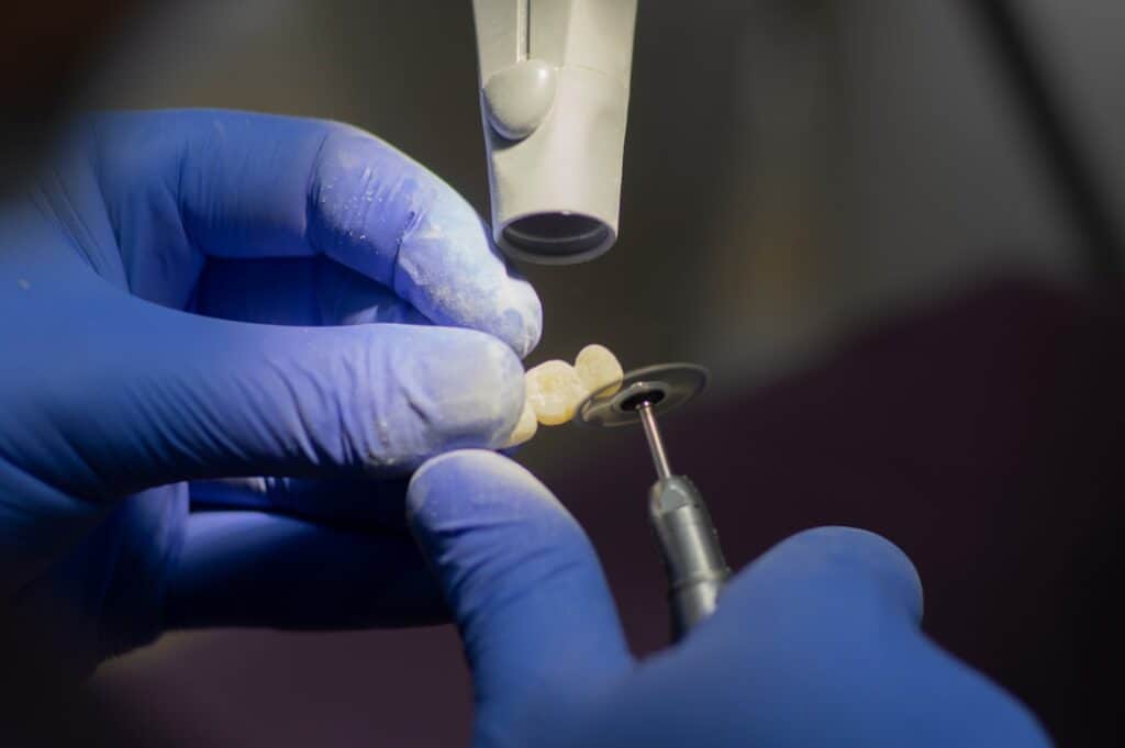 Customised Dental Solutions: Crowns, Aligners, and Implants Cambridge